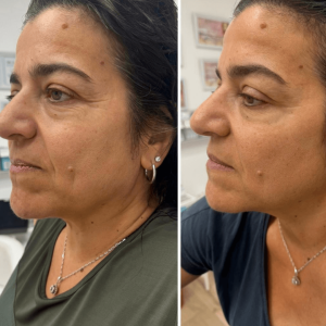 עיצוב-ללא-שם-2024-10-21T113926.808