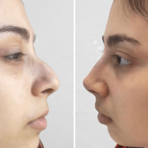 עיצוב-ללא-שם-2024-10-21T113945.746