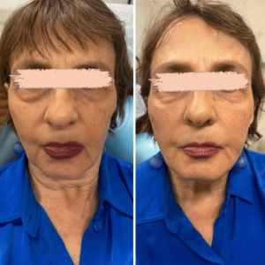 עיצוב-ללא-שם-2024-10-21T114007.712