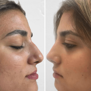 עיצוב-ללא-שם-2024-10-21T114036.050