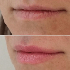 עיצוב-ללא-שם-2024-10-21T114045.729