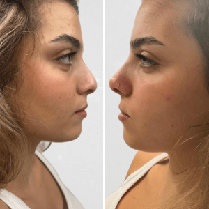 עיצוב-ללא-שם-2024-10-21T114058.740