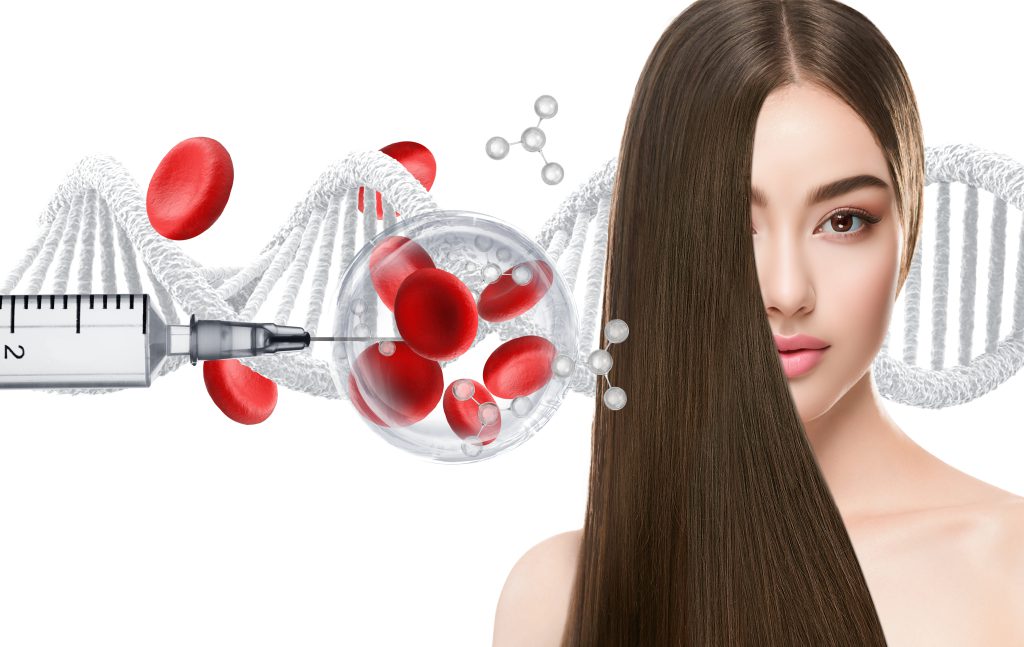 טיפולי IPRF באזור מרכז השרון