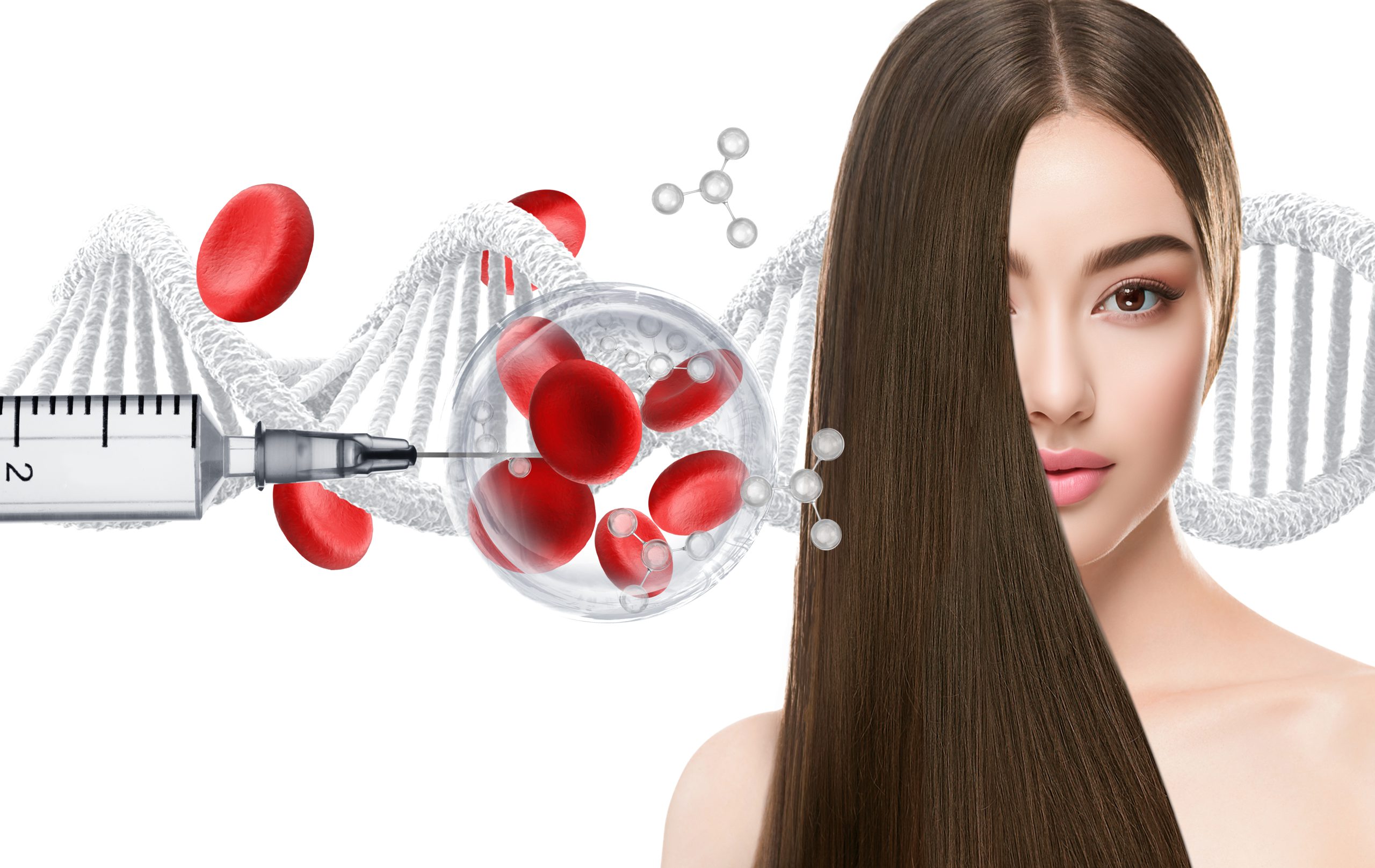 טיפולי IPRF באזור מרכז השרון